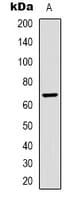 ALB / Serum Albumin Antibody
