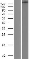 DICER1 / Dicer Protein (Over-Expression Lysate Myc-DDK (Flag))