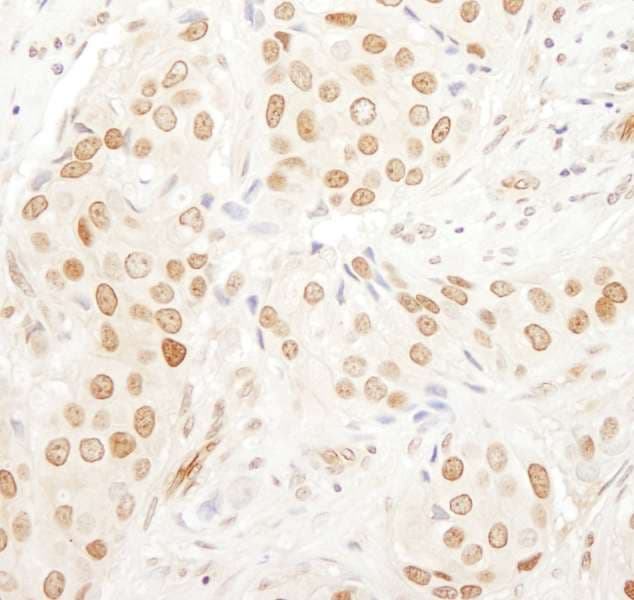 CD3EAP Antibody (aa404-454)