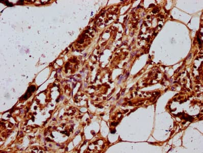 HIST1H2BN Antibody