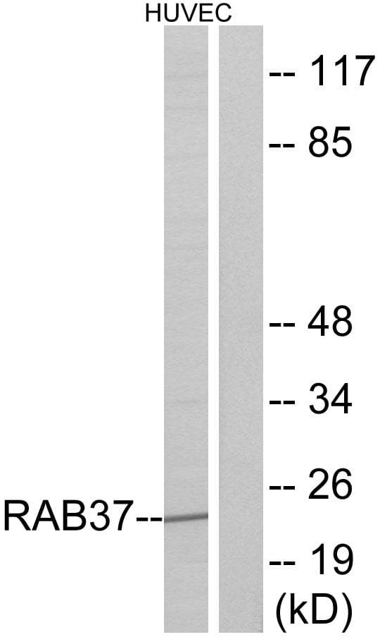 Polyclonal Rabbit anti-Human RAB37 Antibody (IHC, WB)