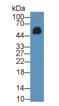 Mouse Anti-Human IgG2 Secondary Antibody
