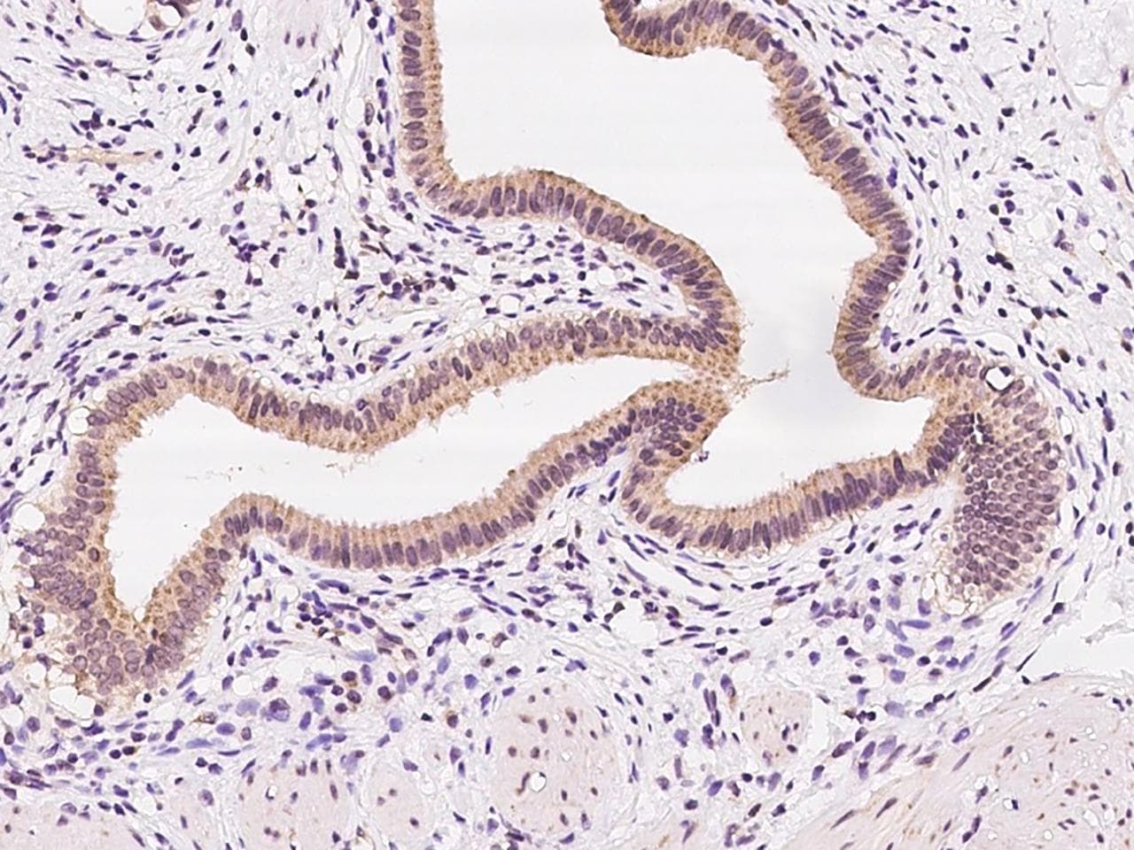 Polyclonal Rabbit anti-Human FAR2 Antibody (IHC, IF)