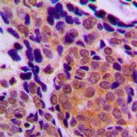 TP63 / p63 Antibody (C-Terminus)