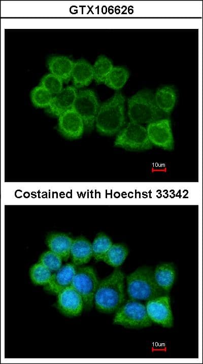 IHC-plus™ Alpha SNAP Antibody (aa78-295)