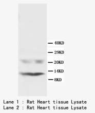 PLN / Phospholamban Antibody (N-Terminus, Sepharose)