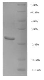 Pig NGF Protein (Recombinant 6His-SUMO, N-terminus)