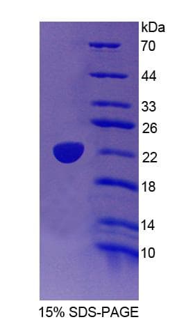 Human TRERF1 Protein (Recombinant His-T7)
