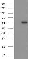 TP53 / p53 Antibody (clone OTI5D9)