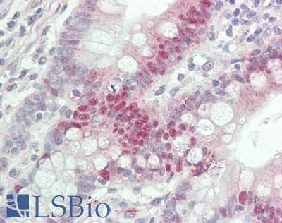 IHC-plus™ Polyclonal Rabbit anti-Human DPYSL2 / CRMP2 Antibody (aa461-510, IHC, WB)