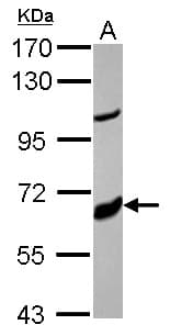 CYP17 / CYP17A1 Antibody