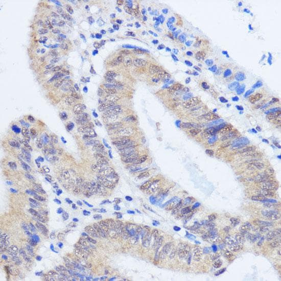 RBM39 Antibody