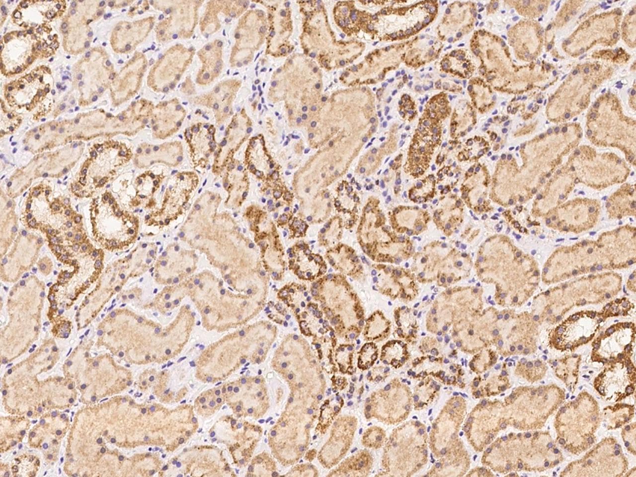 Polyclonal Rabbit anti-Human OR5V1 Antibody (IHC)