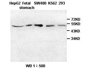 Polyclonal Rabbit anti-Human ST13 Antibody (WB)