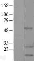 HSPB1 / HSP27 Protein (Over-Expression Lysate Myc-DDK (Flag))