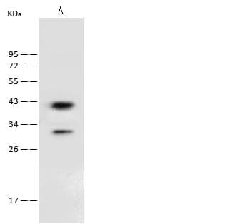 Polyclonal Rabbit anti-Human PSAT1 Antibody (IHC, WB)
