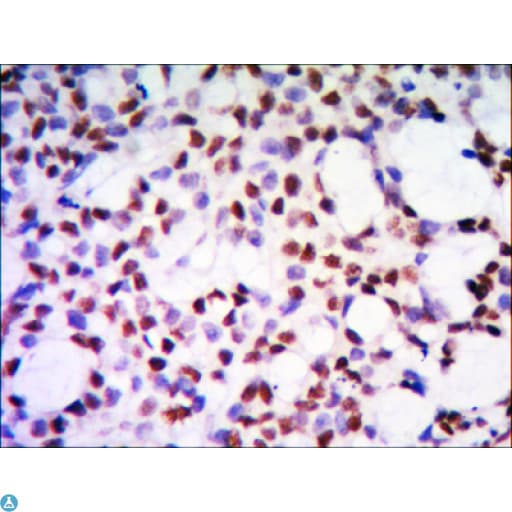 PHAP1 / ANP32A Antibody