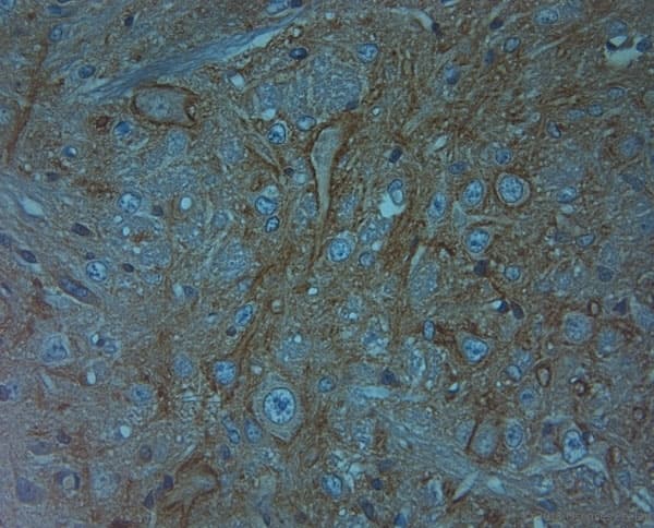 Polyclonal Rabbit anti-Human ACAN / Aggrecan Antibody (aa200-250, IHC)
