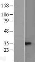TNFRSF13B / TACI Protein (Over-Expression Lysate Myc-DDK (Flag))