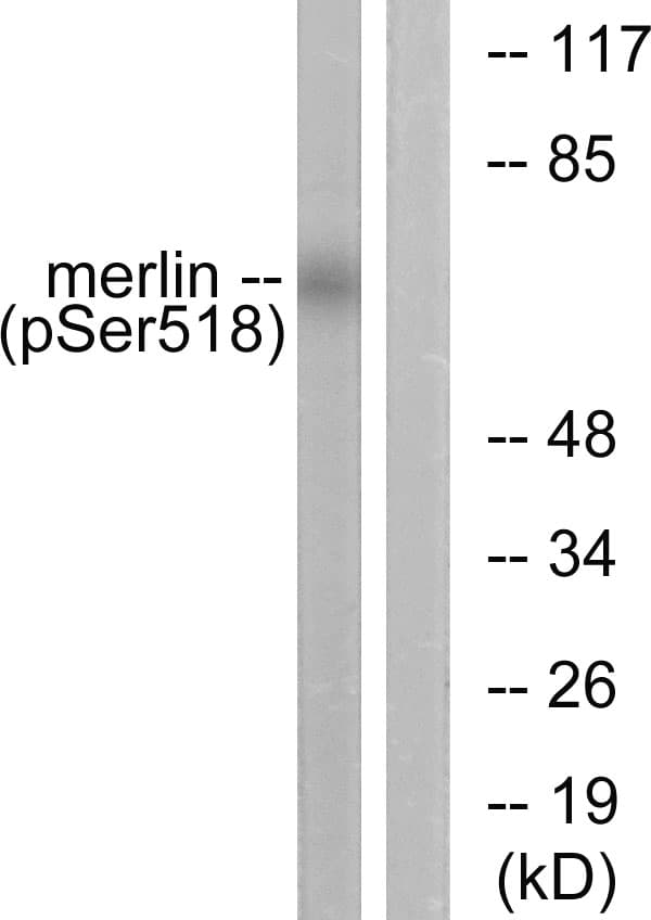 NF2 / Merlin Antibody (phospho-Ser518)