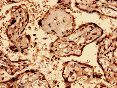 BGN / Biglycan Antibody