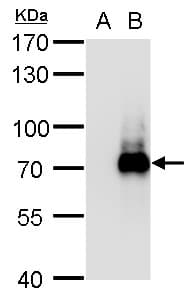 IHC-plus™ HT2A / TRIM32 Antibody (aa1-289)
