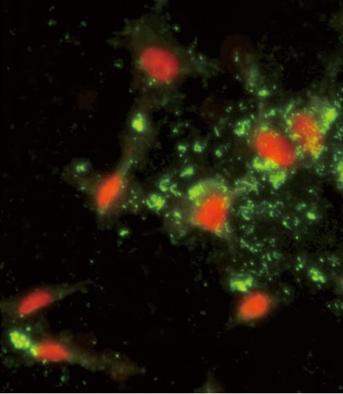 Polyclonal Rabbit anti-Human ARPC1A Antibody (aa286-315, IHC, IF, WB)