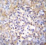 TSNARE1 Antibody (aa363-391)