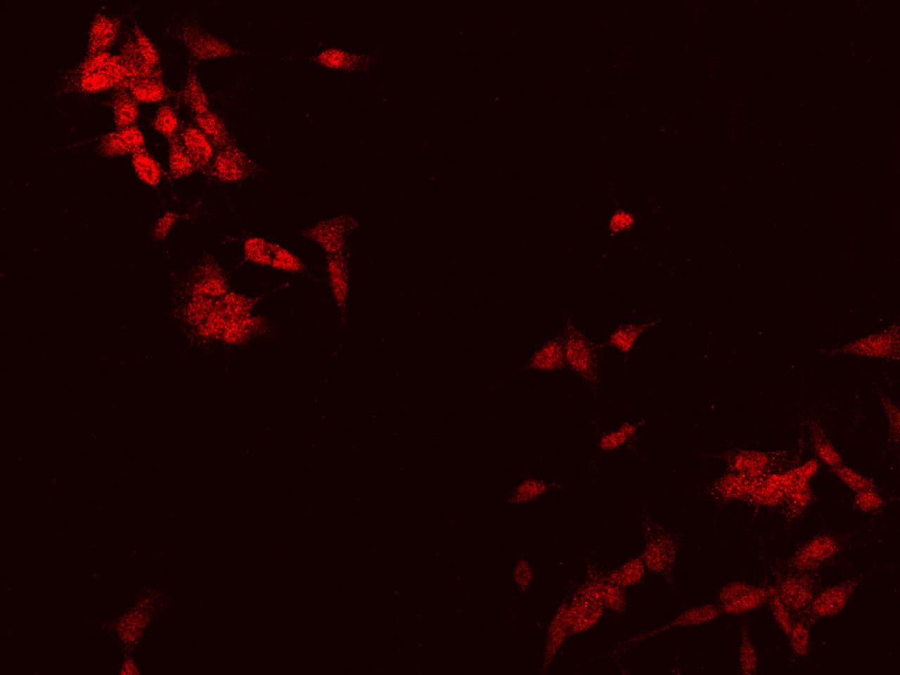 FNDC4 Antibody