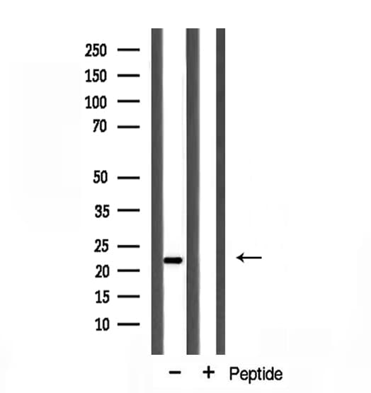 PPIF / Cyclophilin F Antibody