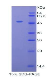 Bovine ORM1 / Orosomucoid Protein (Recombinant His-GST)