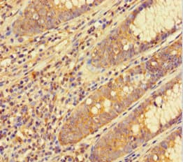 RAP74 / GTF2F1 Antibody