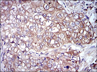Monoclonal Mouse anti-Human NF-L / NEFL Antibody (clone 2G10, IHC, IF, WB)