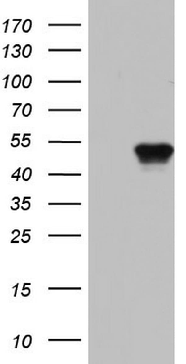 BFSP2 Antibody (aa184-415, clone OTI3A2)