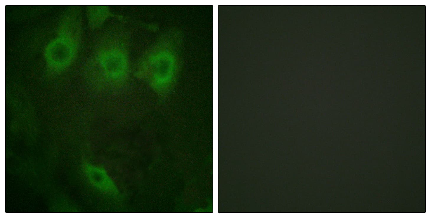 Polyclonal Rabbit anti-Human EGFR Antibody (phospho-Tyr1016, IHC, IF, WB)