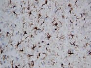 GFAP Antibody (C-Terminus)