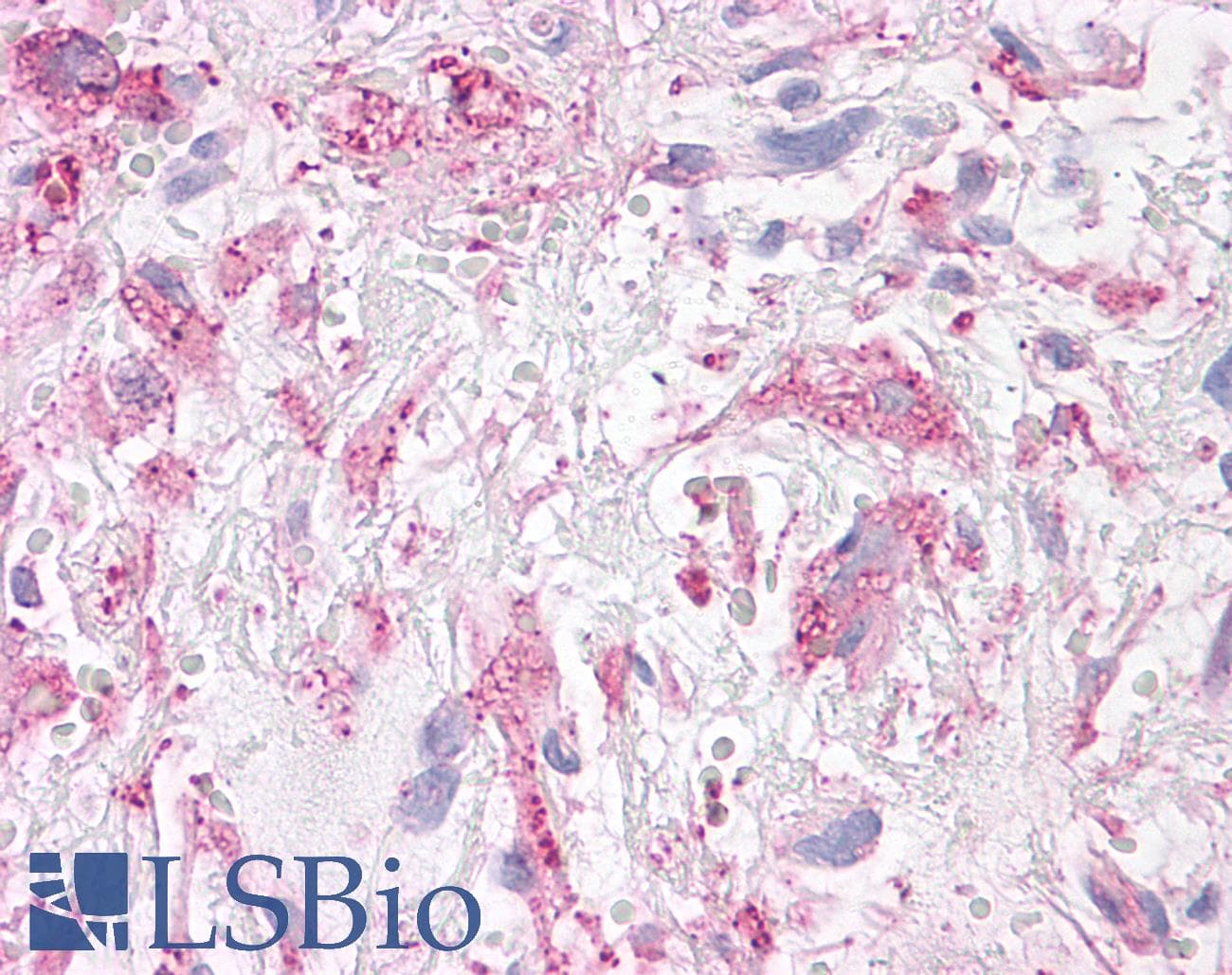 PathPlus™ NEK6 Antibody (N-Terminus)