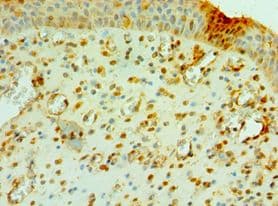 Polyclonal Rabbit anti-Human CNOT8 Antibody (aa1-292, IHC)