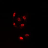 TLE1 / TLE 1 Antibody