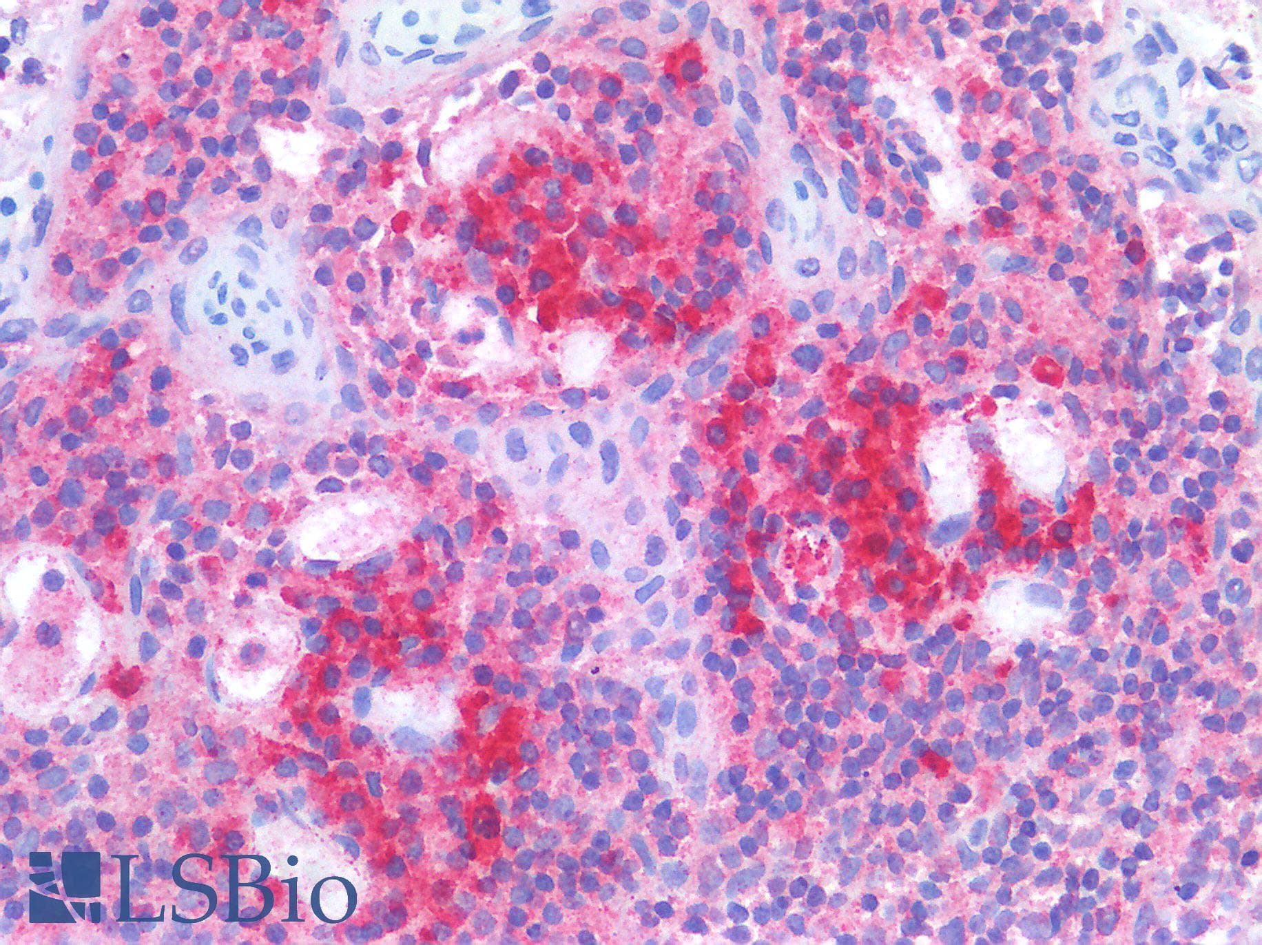 PathPlus™ IFNAR1 / IFNAR Antibody (clone 1H2)