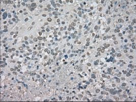 CTAG1B / NY-ESO-1 Antibody (clone OTI2B6)