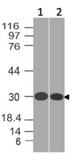 SLC31A1 / CTR1 Antibody
