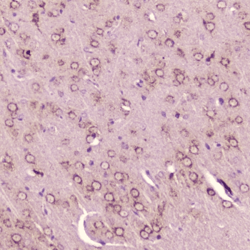 Polyclonal Rabbit anti-Mouse CALCA Antibody (IHC)