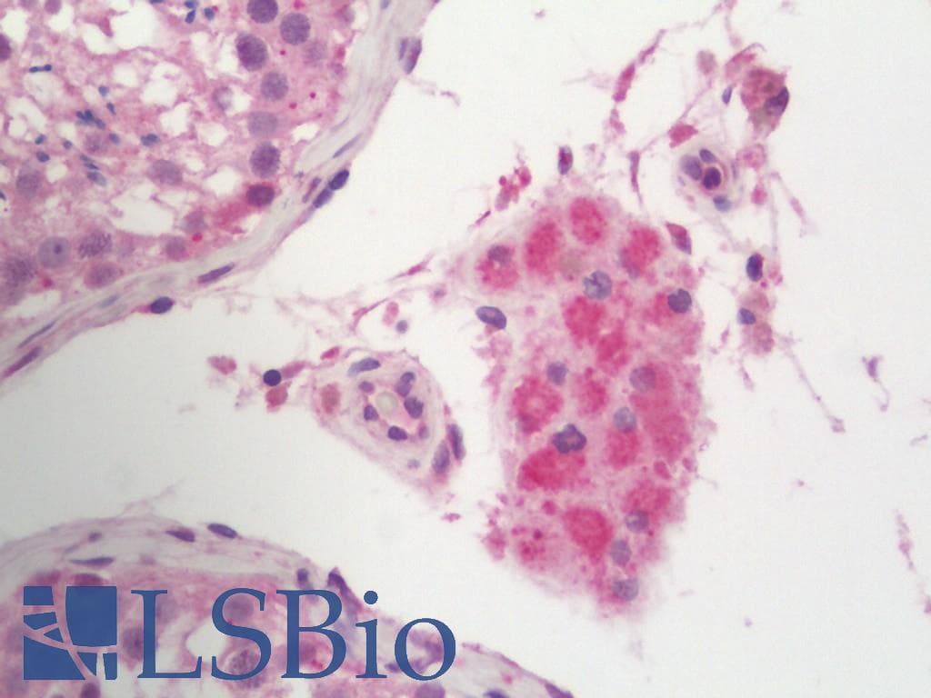 PHPT1 Antibody (HRP)