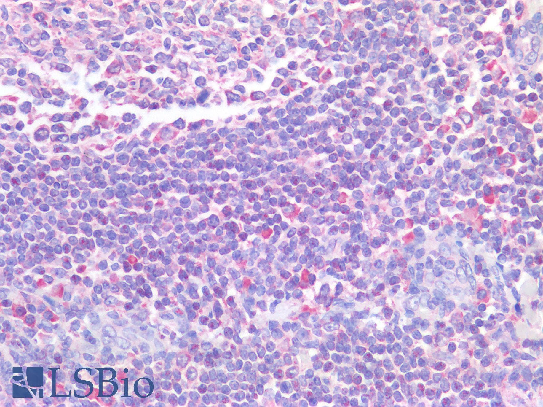 IHC-plus™ STAT5A Antibody (aa681-692)