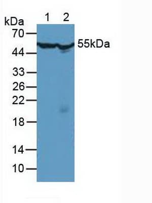 CCT2 / CCT Beta Antibody (aa1-488)