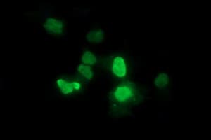 ZSCAN21 / Zipro1 Antibody (clone OTI3D4)