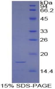 Bovine HIF1A / HIF1 Alpha Protein (Recombinant His)