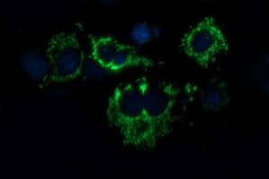 ACAA2 Antibody (clone OTI3H9)