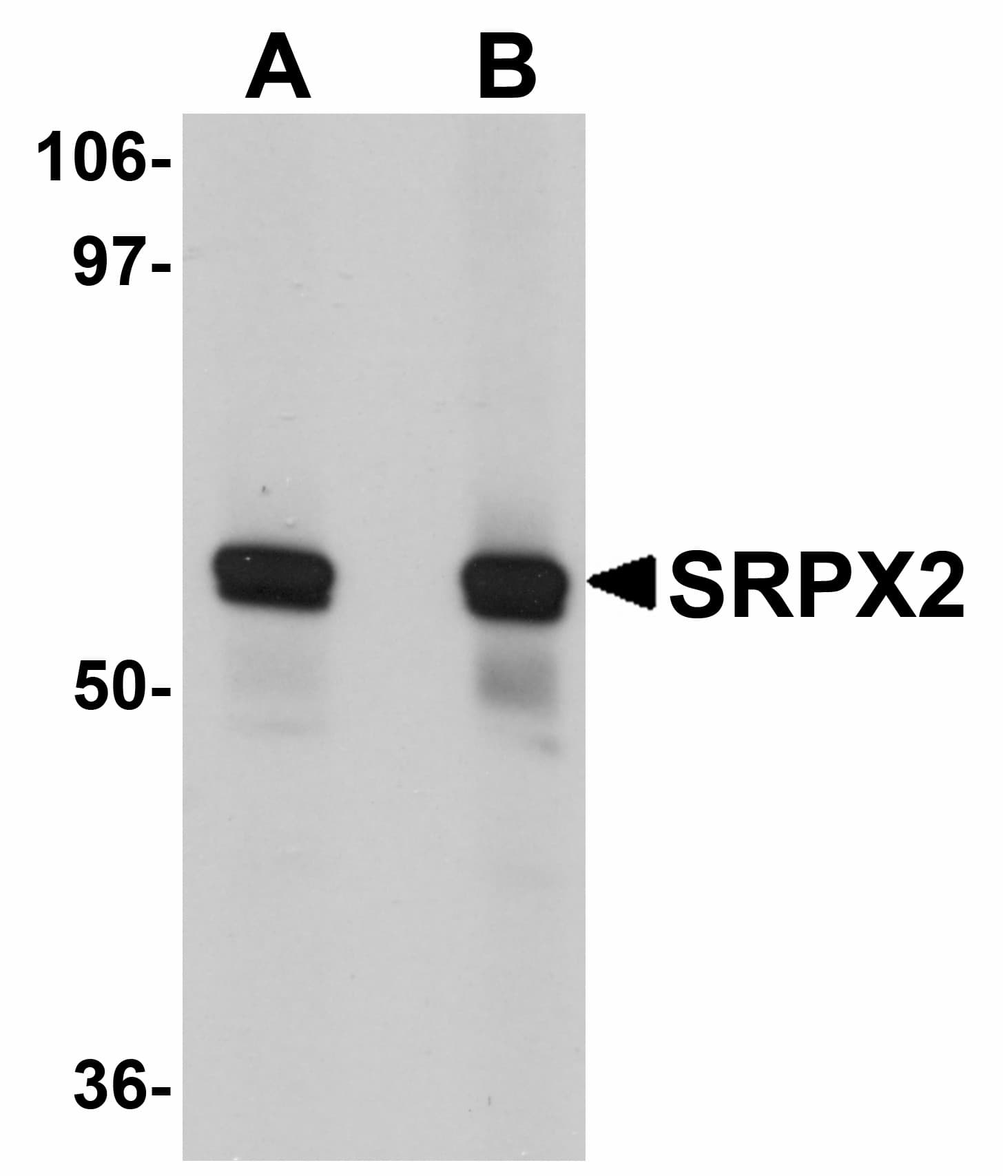 IHC-plus™ SRPX2 Antibody